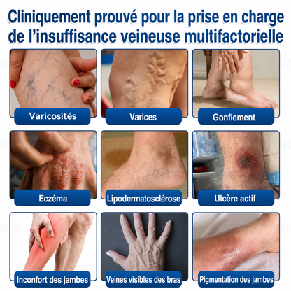 🌴🌴GFOUK® Réparation Veineuse Baume Aux Micro-Aiguilles