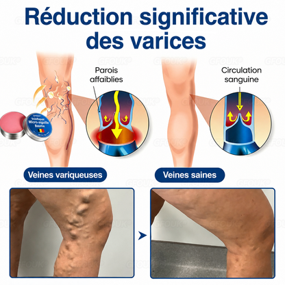 🌴🌴GFOUK® Réparation Veineuse Baume Aux Micro-Aiguilles