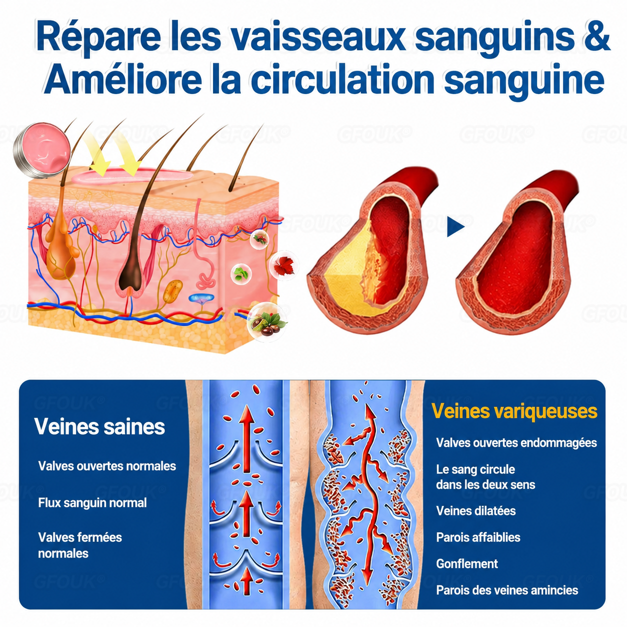 🌴🌴GFOUK® Réparation Veineuse Baume Aux Micro-Aiguilles