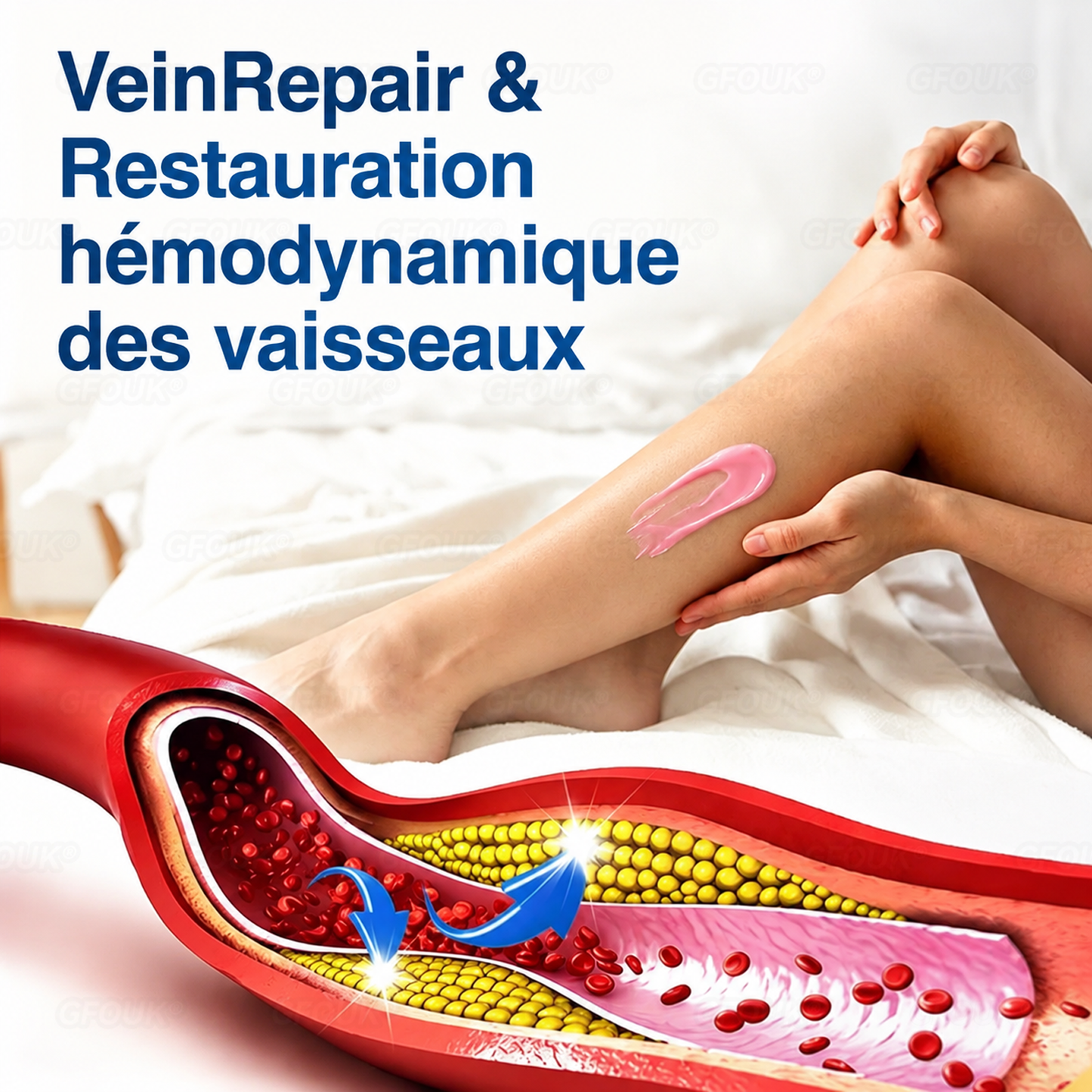 🌴🌴GFOUK® Réparation Veineuse Baume Aux Micro-Aiguilles